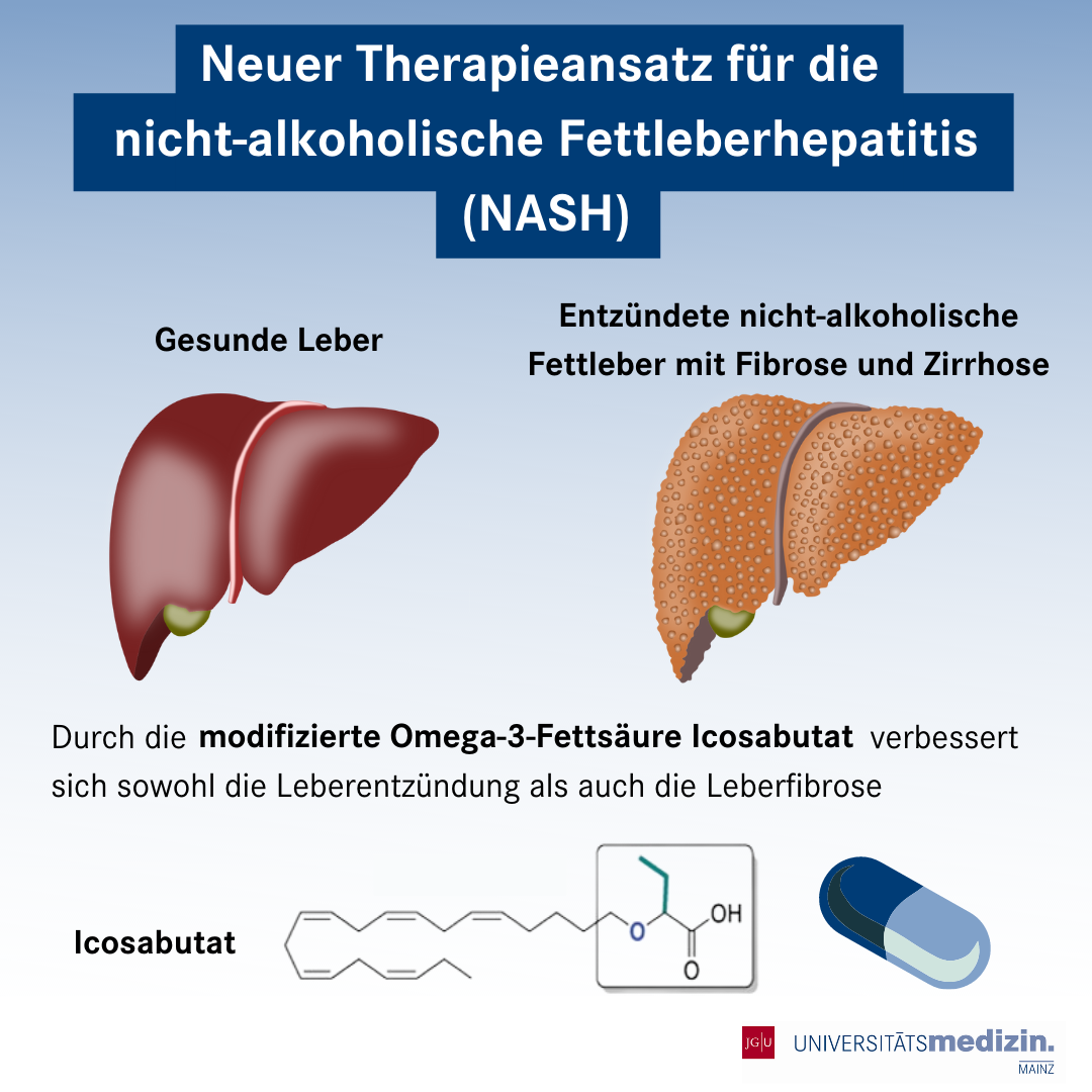 Forschende der Universitätsmedizin Mainz entwickeln Wirkstoff gegen Fettleberhepatitis