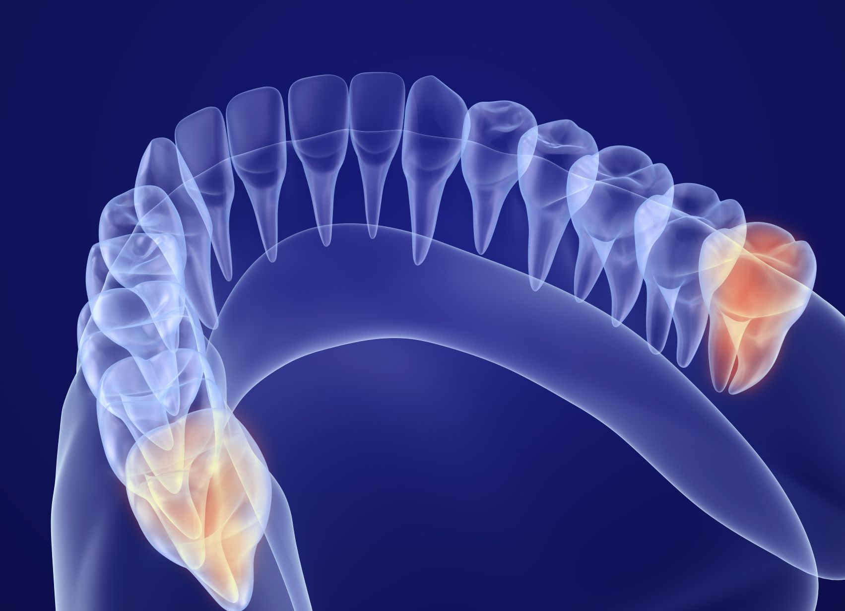 Zahnwurzelbehandlung: Nelkenöl betäubt den Schmerz