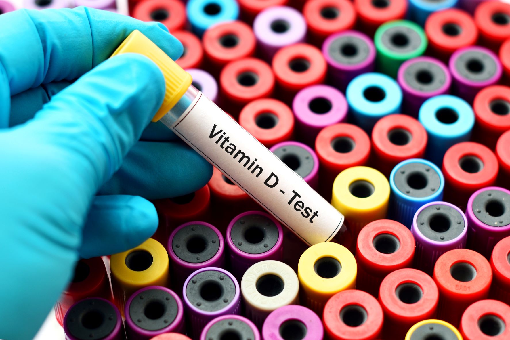 Carmen Franken: Vitamin D ist in vieler Munde, warum ist es so wichtig?