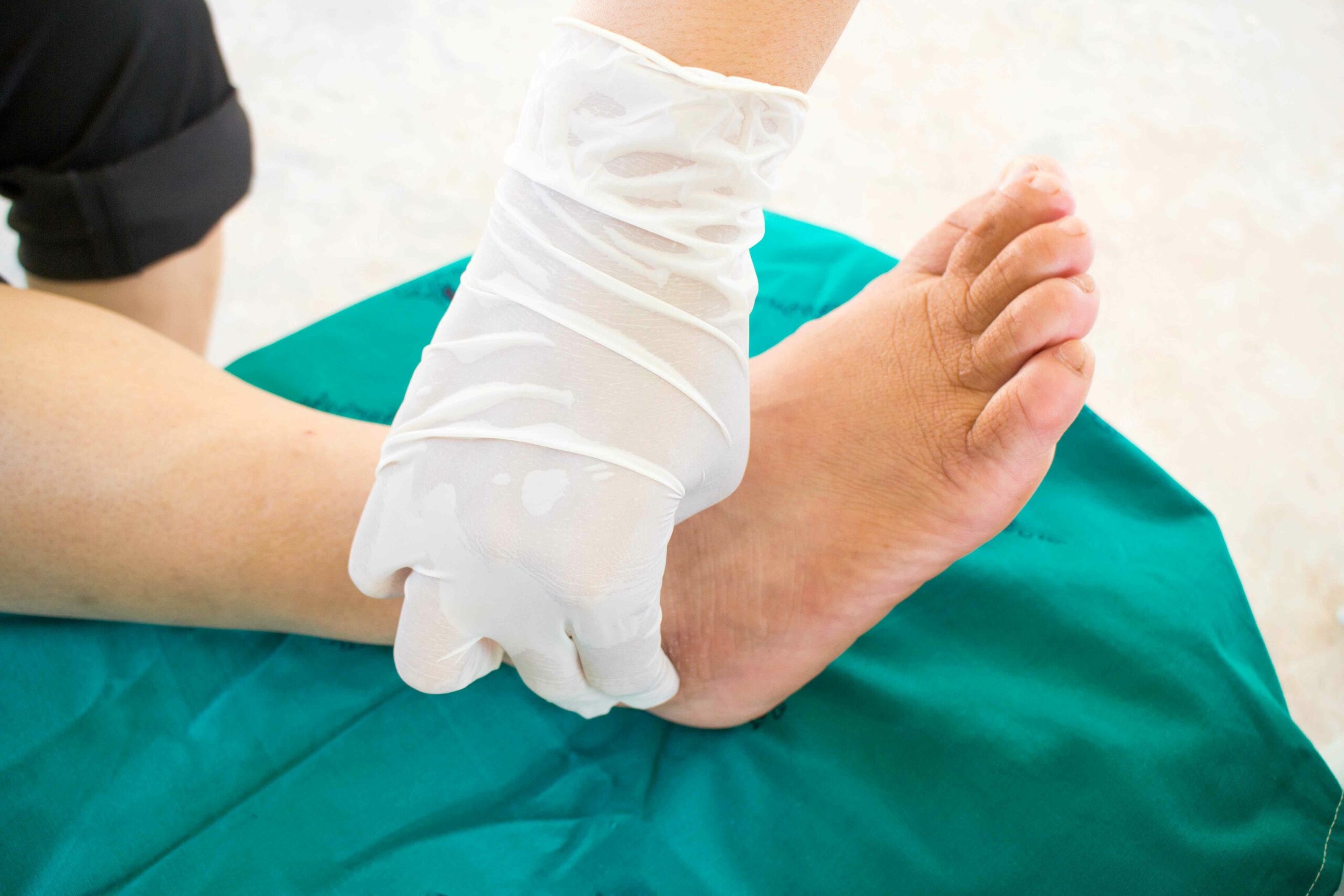 Wie Menschen mit Diabetes einen „Charcot-Fuß“ erkennen und verhindern